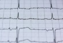 stellar pulse beam signal
